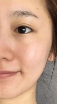 Before treatment results
